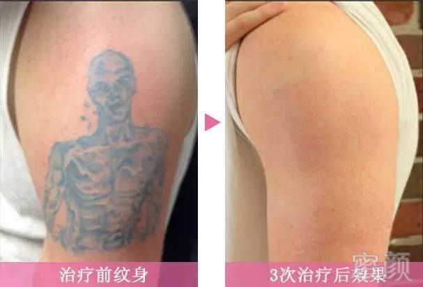 https://img.miyanlife.com/mnt/timg/190225/123T14V3-6.jpg