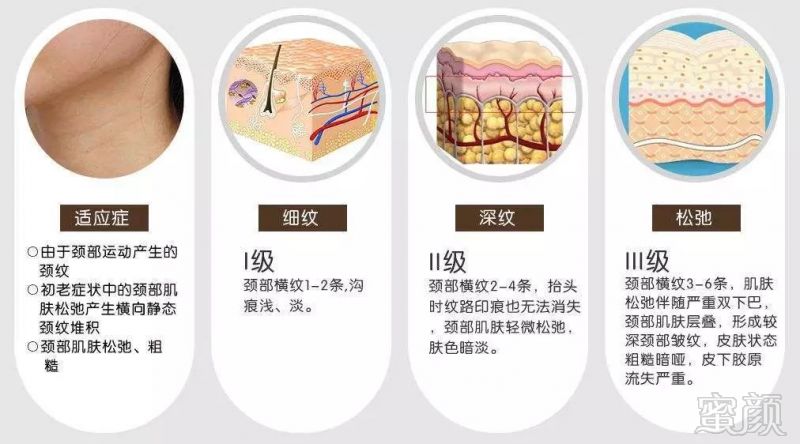 案例图片