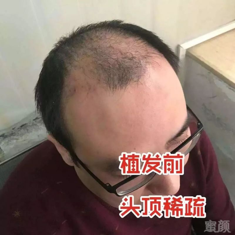 https://img.miyanlife.com/mnt/timg/190225/1300294392-6.jpg