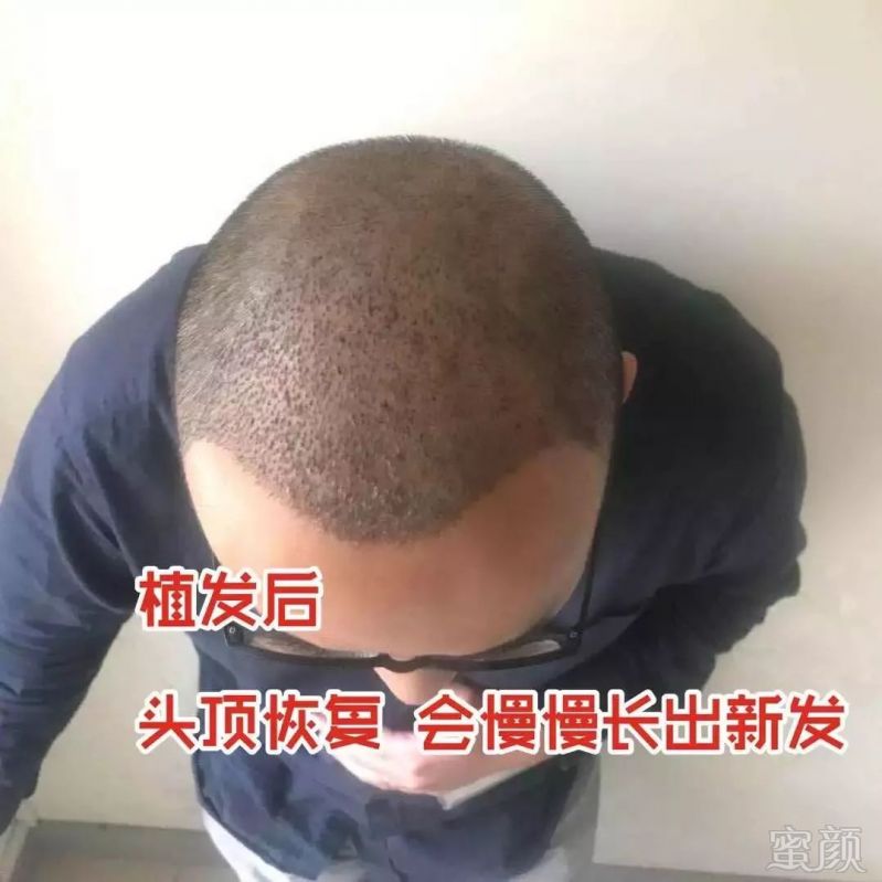 https://img.miyanlife.com/mnt/timg/190225/1300303641-8.jpg