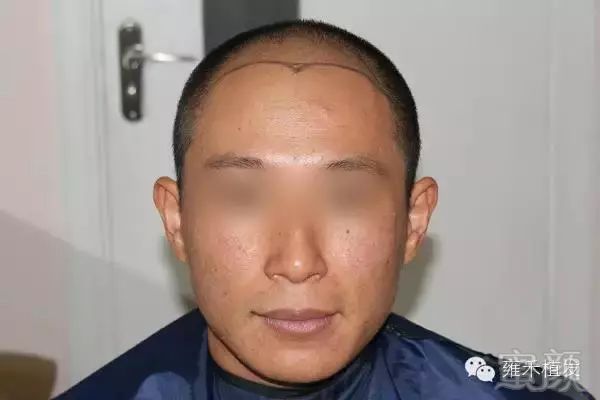 https://img.miyanlife.com/mnt/timg/190225/13055L315-0.jpg