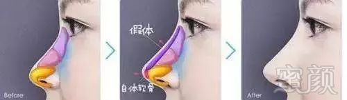 https://img.miyanlife.com/mnt/timg/190225/1333523P3-9.jpg