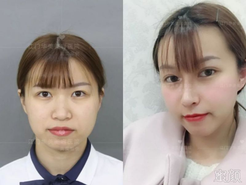https://img.miyanlife.com/mnt/timg/190225/1352154I5-2.jpg