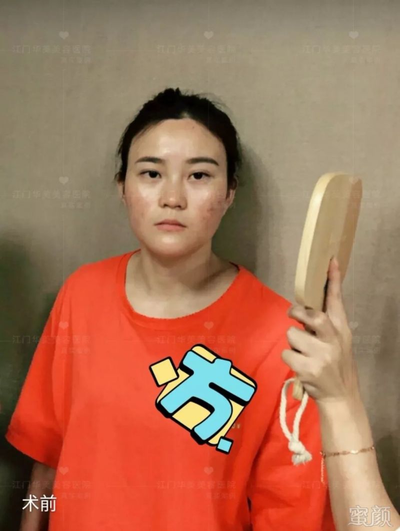 https://img.miyanlife.com/mnt/timg/190225/13521L402-4.jpg