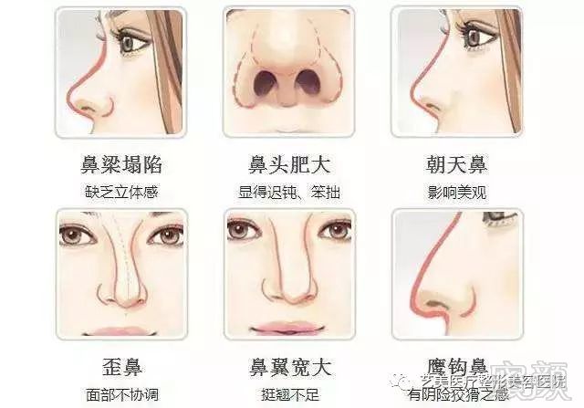 https://img.miyanlife.com/mnt/timg/190225/1359301V6-1.jpg