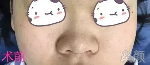 https://img.miyanlife.com/mnt/timg/190225/135Q03603-0.jpg