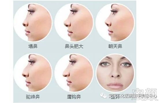 https://img.miyanlife.com/mnt/timg/190225/135U43453-4.jpg