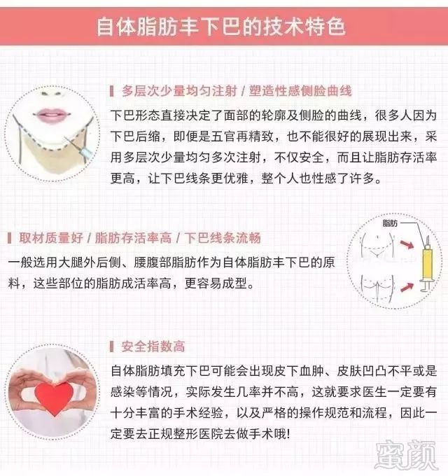 https://img.miyanlife.com/mnt/timg/190225/135U4F23-8.jpg
