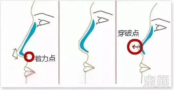 https://img.miyanlife.com/mnt/timg/190225/140004N08-6.jpg