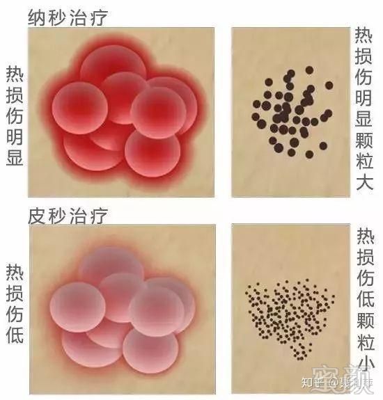 https://img.miyanlife.com/mnt/timg/190226/1214525117-1.jpg