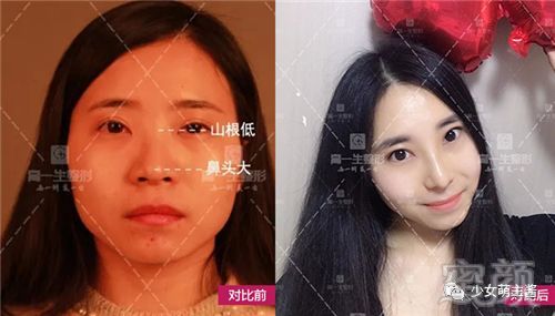 案例图片