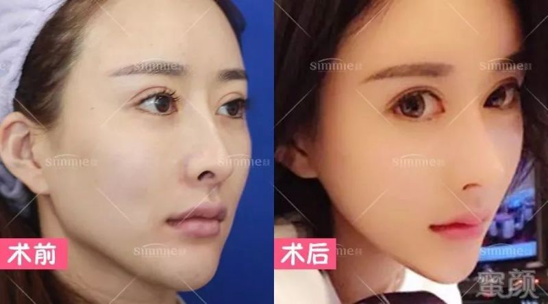 案例图片