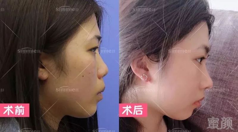 案例图片