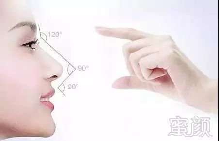 https://img.miyanlife.com/mnt/timg/190226/1405053351-3.jpg 案例图片