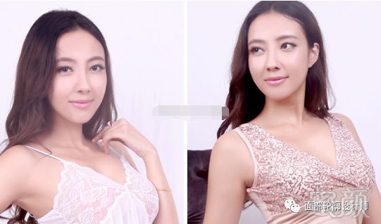 https://img.miyanlife.com/mnt/timg/190226/1410222L1-4.jpg