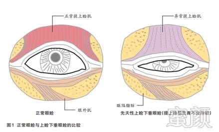 案例图片