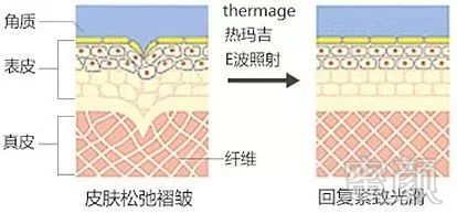 https://img.miyanlife.com/mnt/timg/190226/1414512W0-12.jpg