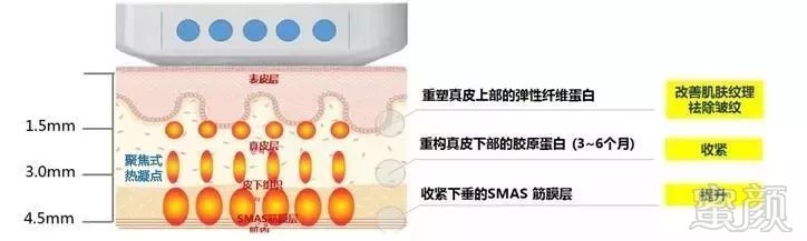 https://img.miyanlife.com/mnt/timg/190226/1414513N9-9.jpg