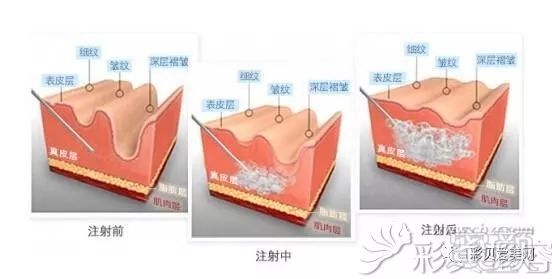 https://img.miyanlife.com/mnt/timg/190226/14203C5F-2.jpg