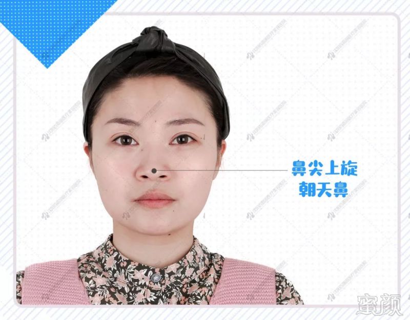 https://img.miyanlife.com/mnt/timg/190226/14354G145-3.jpg