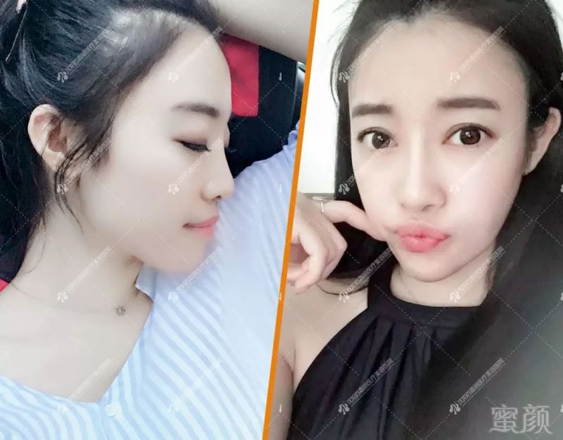 https://img.miyanlife.com/mnt/timg/190226/14355140a-11.jpg
