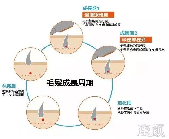 https://img.miyanlife.com/mnt/timg/190226/144023MO-2.jpg