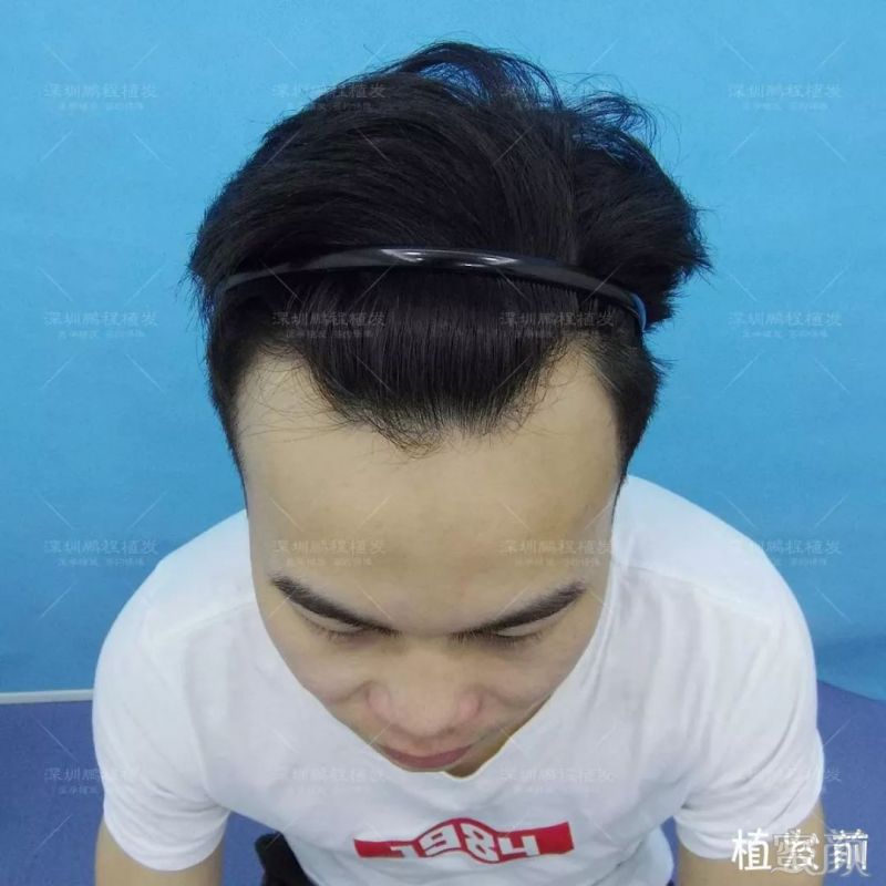 https://img.miyanlife.com/mnt/timg/190226/144250BB-6.jpg