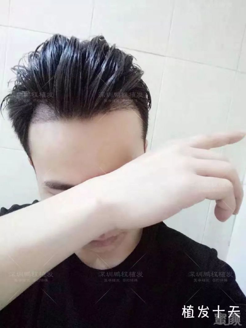https://img.miyanlife.com/mnt/timg/190226/14425122B-8.jpg