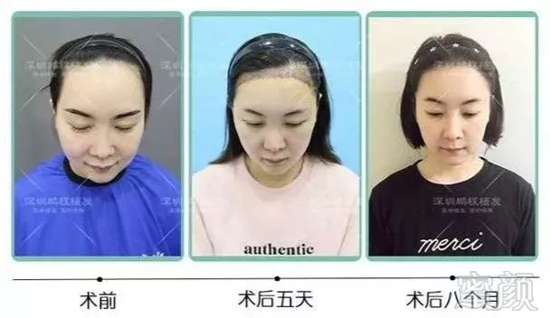 https://img.miyanlife.com/mnt/timg/190226/1442524529-12.jpg