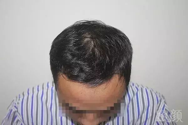 https://img.miyanlife.com/mnt/timg/190226/1444591R7-1.jpg