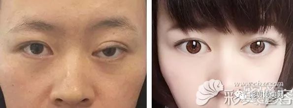 案例图片