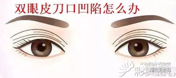 案例图片