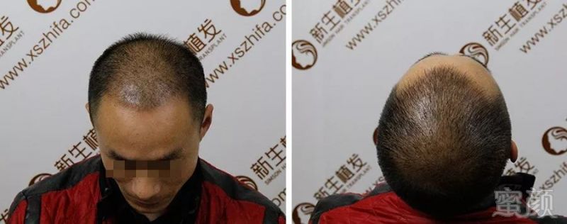 https://img.miyanlife.com/mnt/timg/190226/144KIX8-5.jpg