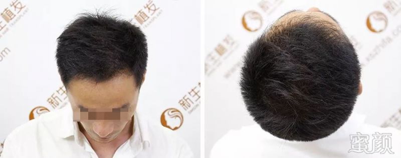 https://img.miyanlife.com/mnt/timg/190226/144KK493-6.jpg