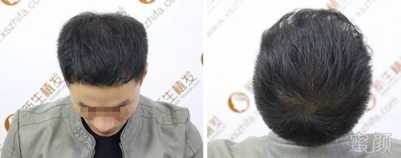 https://img.miyanlife.com/mnt/timg/190226/144KKA2-7.jpg