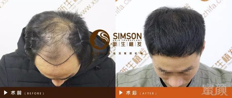 https://img.miyanlife.com/mnt/timg/190226/144KKb8-1.jpg