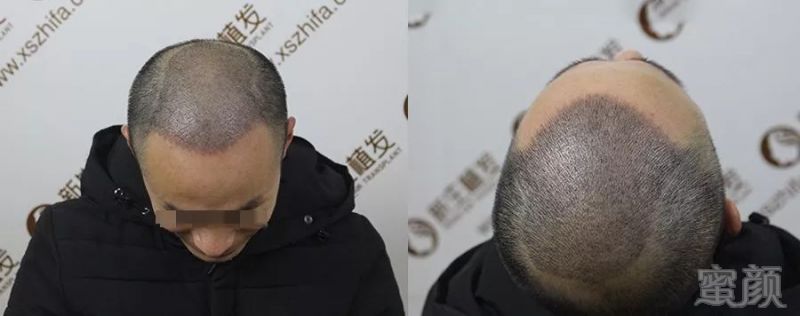 https://img.miyanlife.com/mnt/timg/190226/144KM523-4.jpg