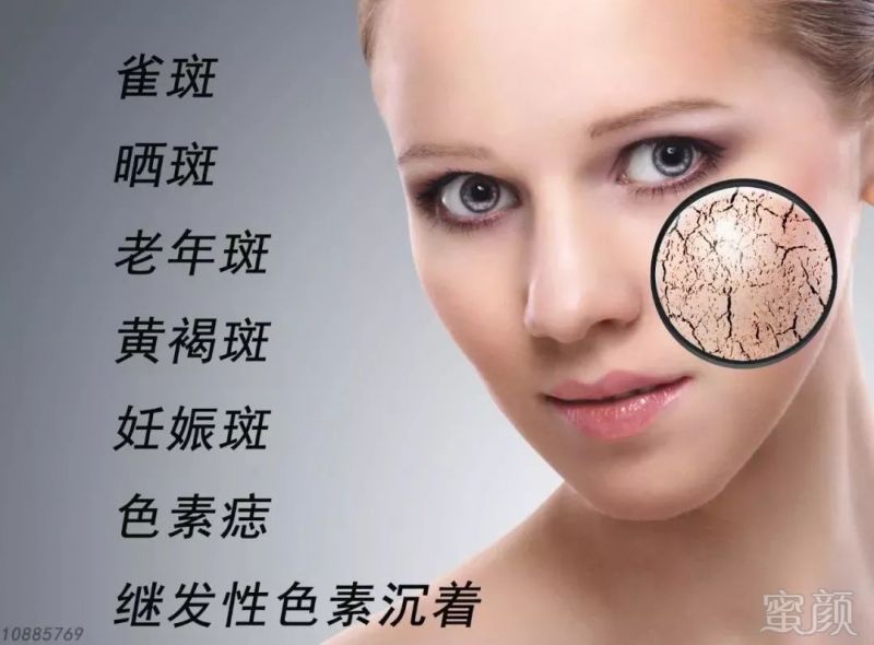 https://img.miyanlife.com/mnt/timg/190227/12492MQ9-4.jpg