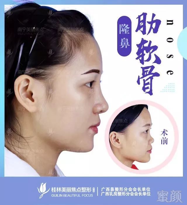 https://img.miyanlife.com/mnt/timg/190227/1251101594-4.jpg