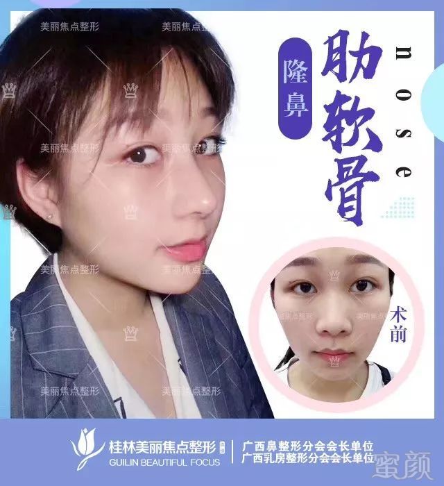 https://img.miyanlife.com/mnt/timg/190227/125110A43-3.jpg