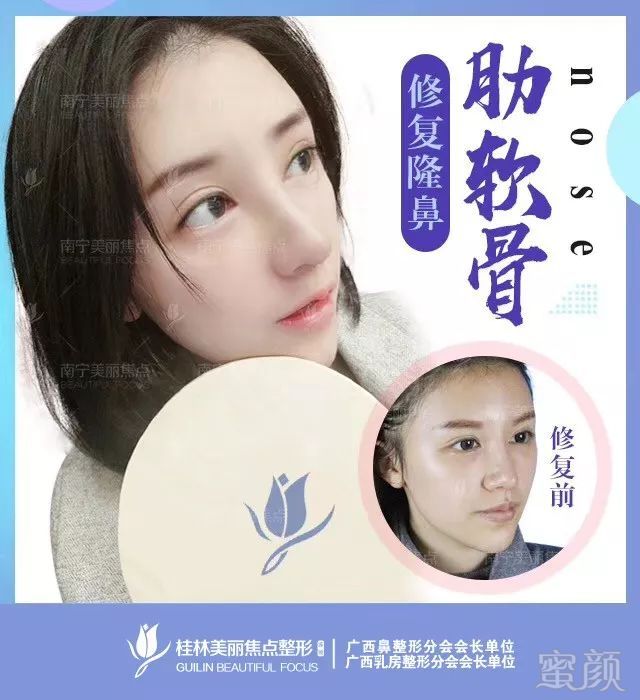 https://img.miyanlife.com/mnt/timg/190227/125110IX-5.jpg