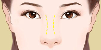 https://img.miyanlife.com/mnt/timg/190227/1252161120-8.jpg