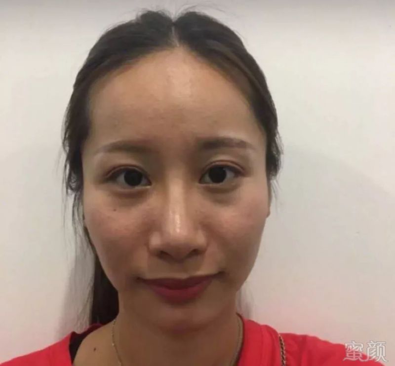 https://img.miyanlife.com/mnt/timg/190227/1252436010-1.jpg