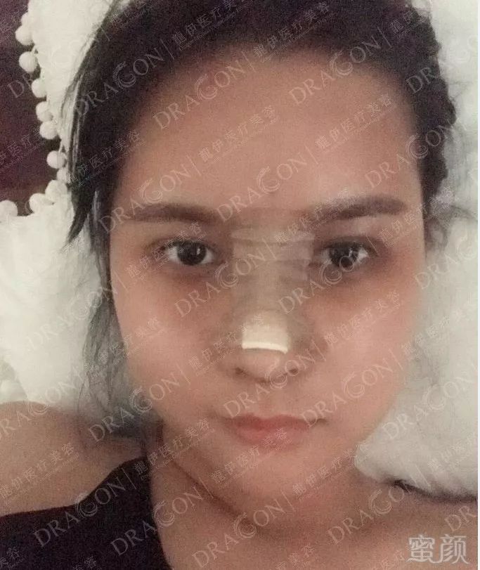 https://img.miyanlife.com/mnt/timg/190227/12552S030-7.jpg