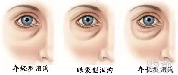 https://img.miyanlife.com/mnt/timg/190227/13030M423-4.jpg