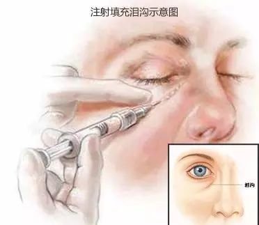 https://img.miyanlife.com/mnt/timg/190227/13030S0G-5.jpg
