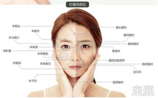 https://img.miyanlife.com/mnt/timg/190227/13030WR8-8.jpg