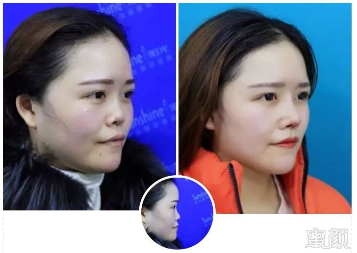 https://img.miyanlife.com/mnt/timg/190227/130502L64-0.jpg