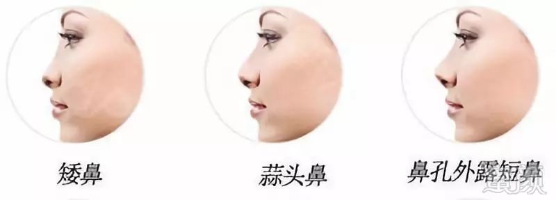 https://img.miyanlife.com/mnt/timg/190227/1305034C8-4.jpg