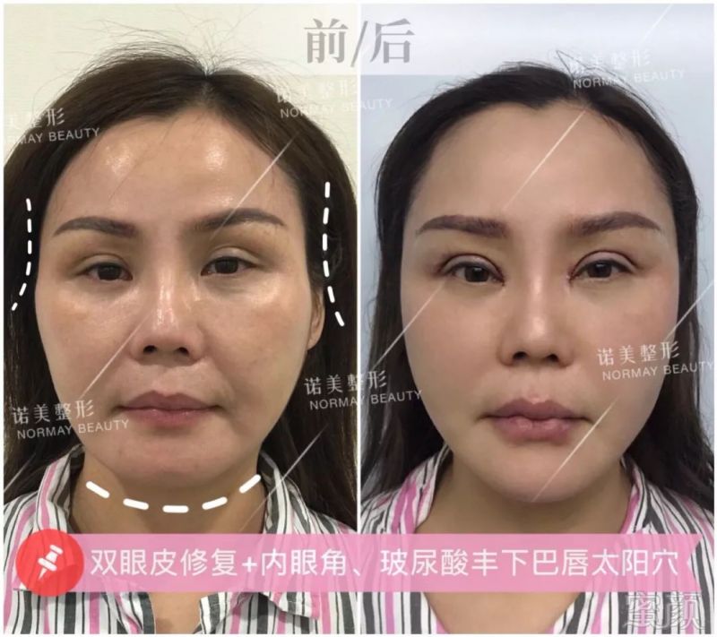 案例图片